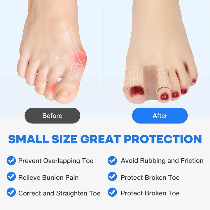 Bunion Relief Toe Separator