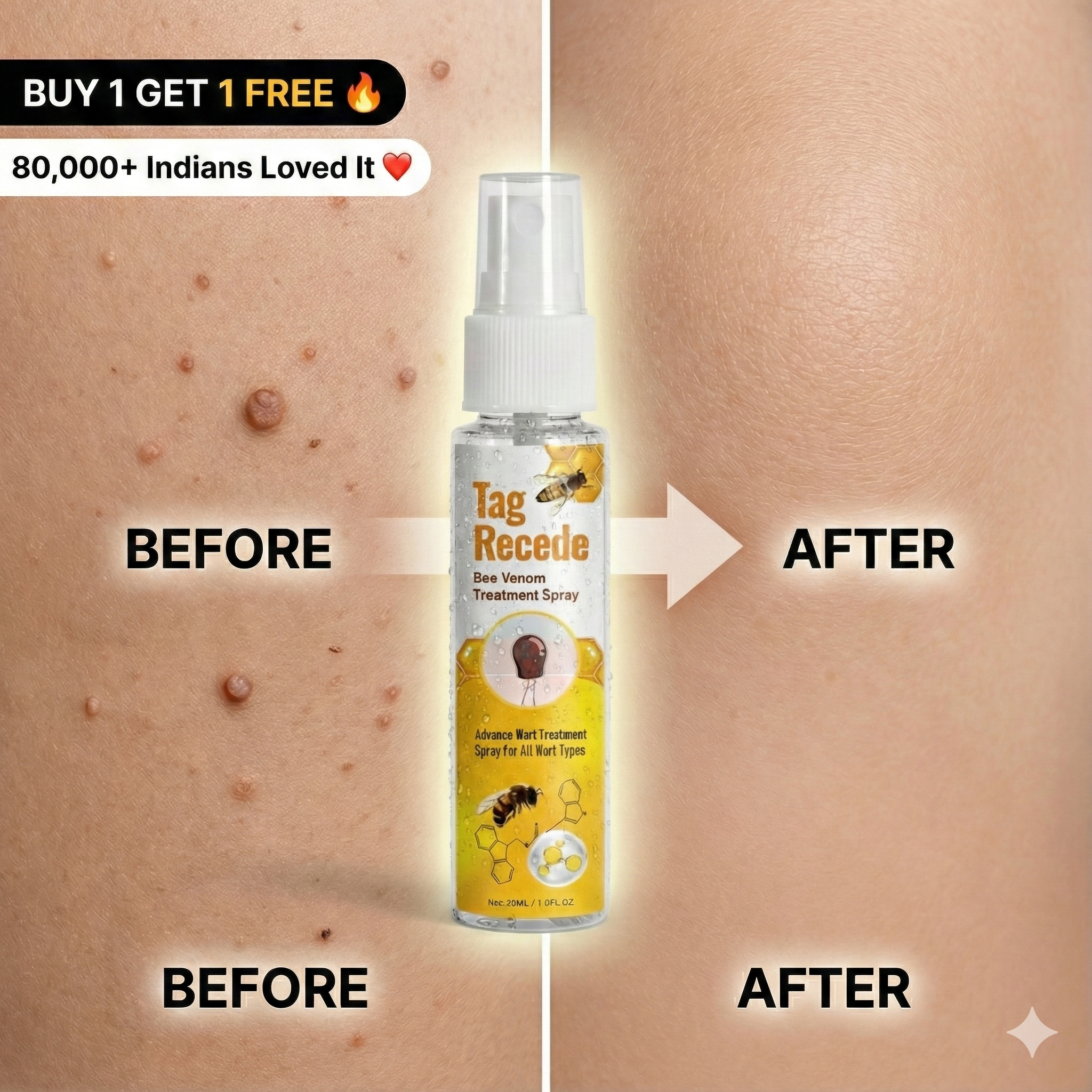 Wart & Skin Tag Remover Spray