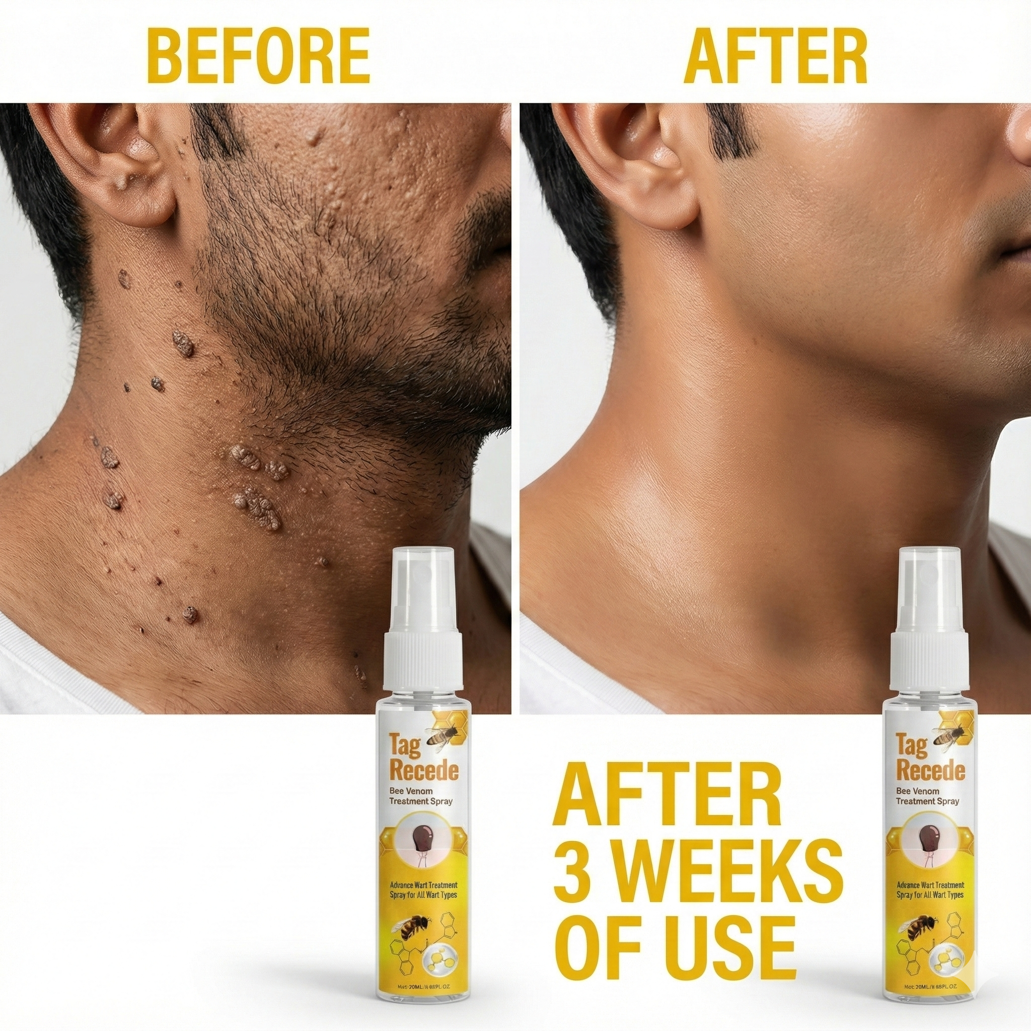 Wart & Skin Tag Remover Spray