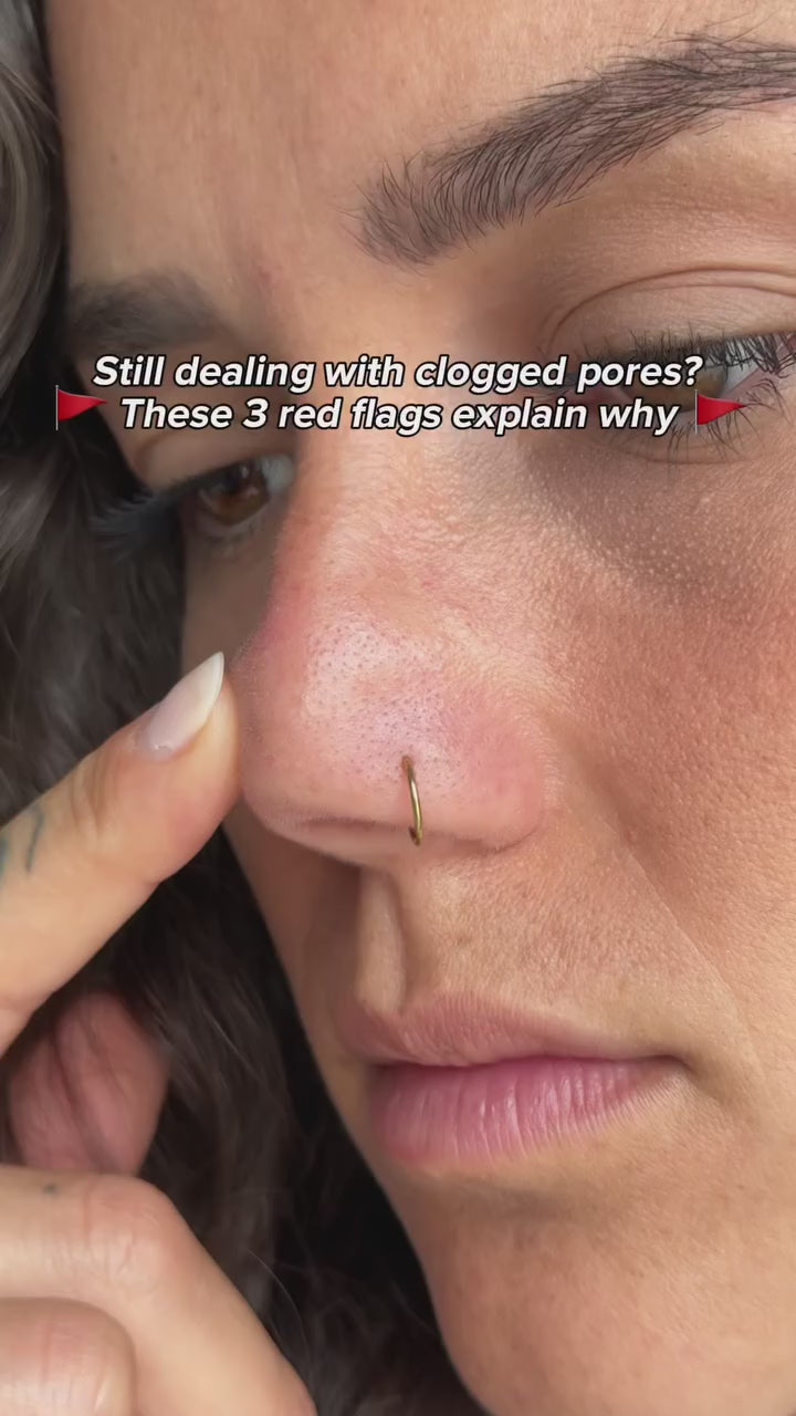 Hydrochloride Blackheads Removing Nose Patches