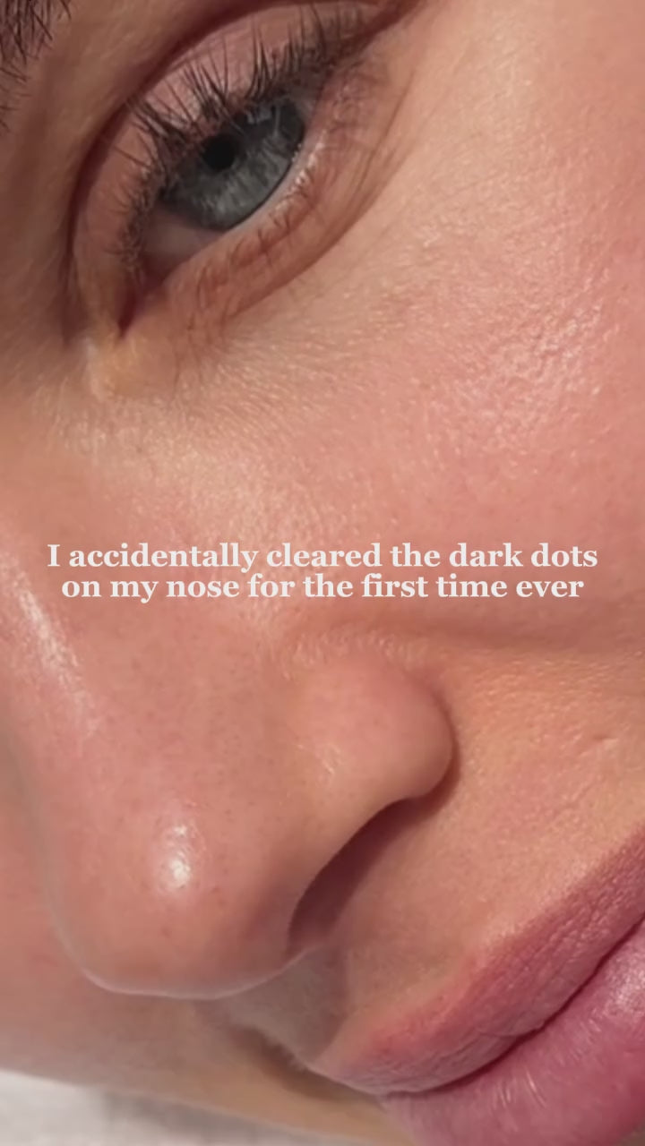 Hydrochloride Blackheads Removing Nose Patches